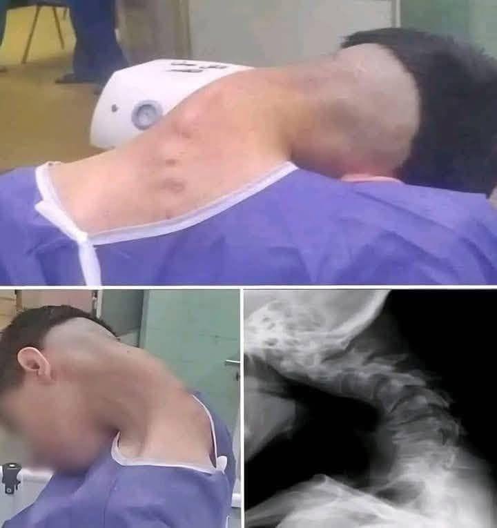 Young man hospitalized because he dropped his ca!