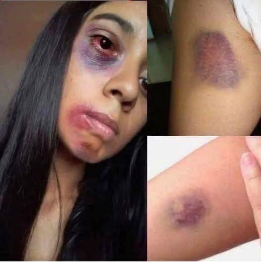 Young woman d!es at the hands of her…See more