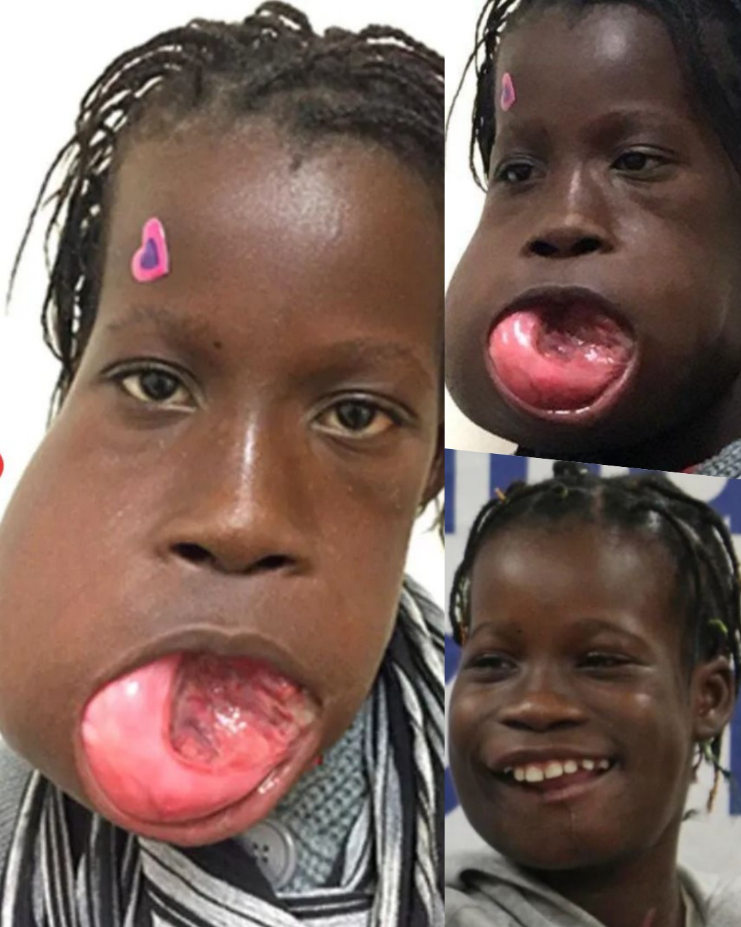 Janet’s Transformation: From Pain to Hope Through a Life-Saving Surgery 8234