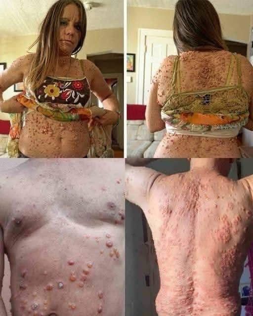 These are the consequences of sleeping co.…See more