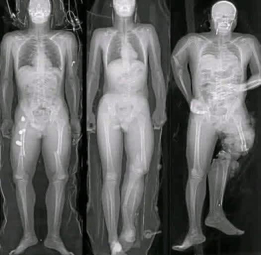 The Truth Behind Social Media Scares About COVID Vaccines”