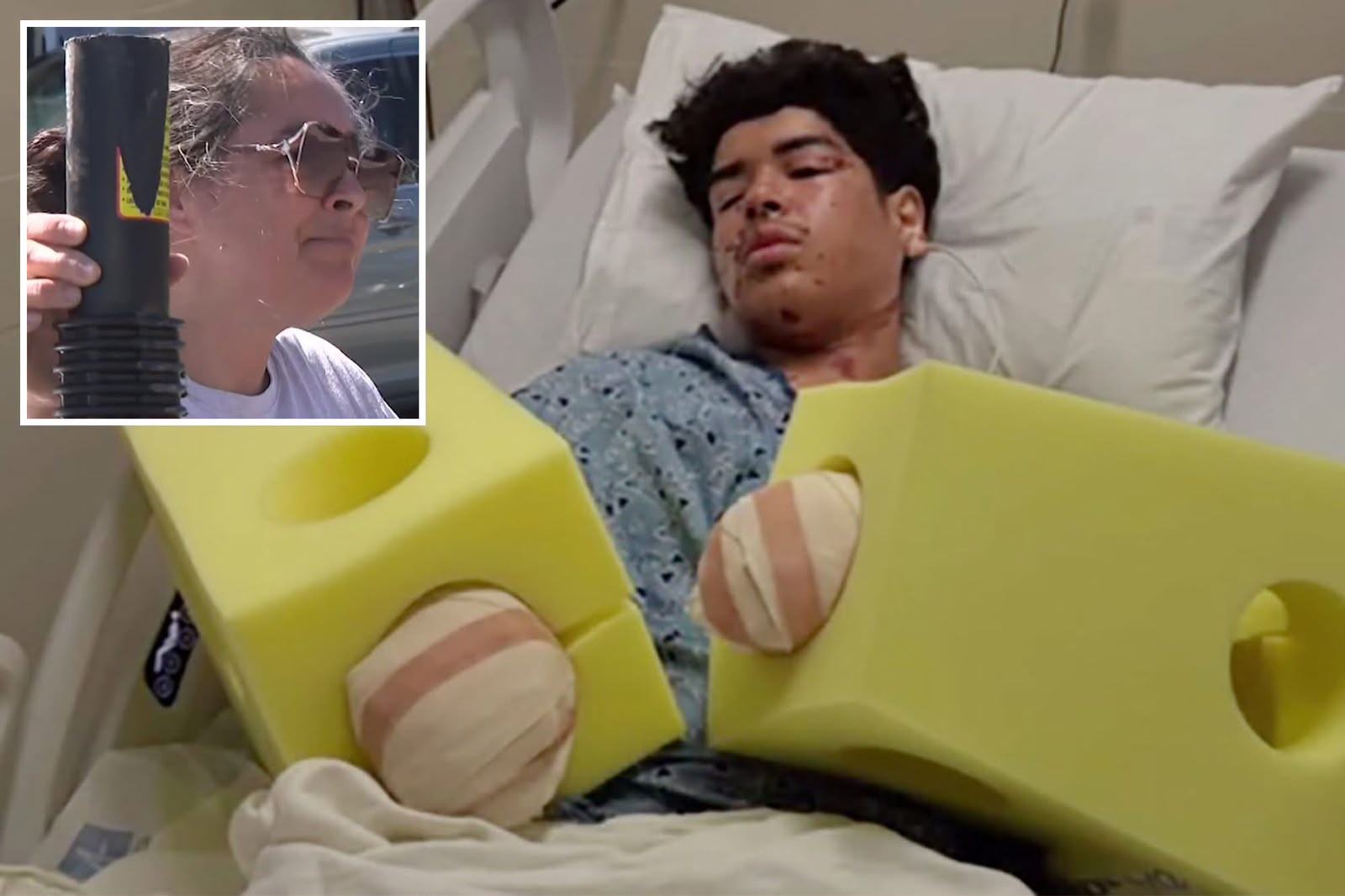 California mom goes ballistic after teen son’s hands are blown to pieces after near-deadly mistake